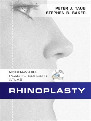 cover image of Rhinoplasty